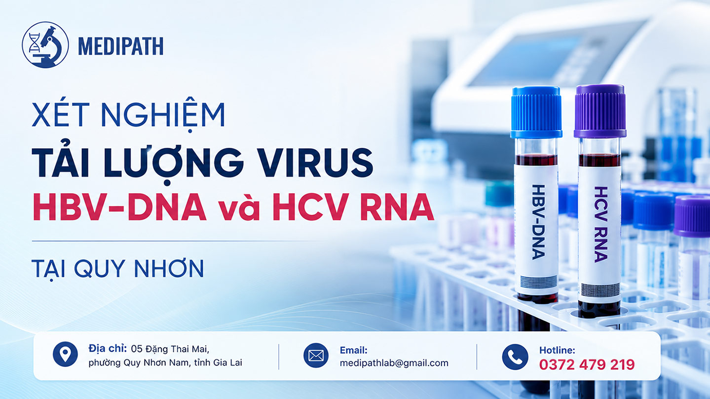 Xet nghiem tai luong virus tai Quy Nhon