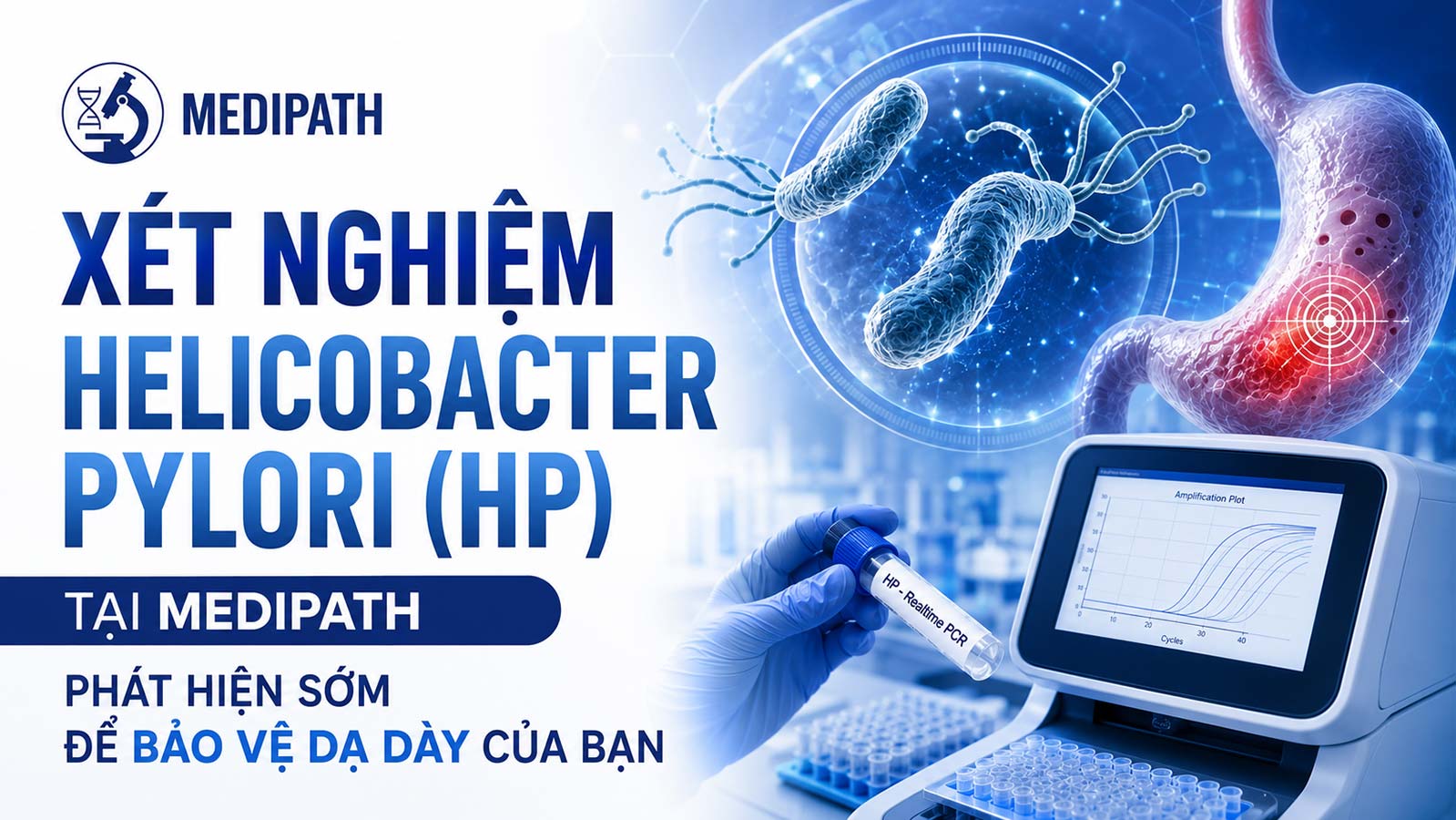 Xét nghiệm Helicobacter Pylori tại Quy Nhơn
