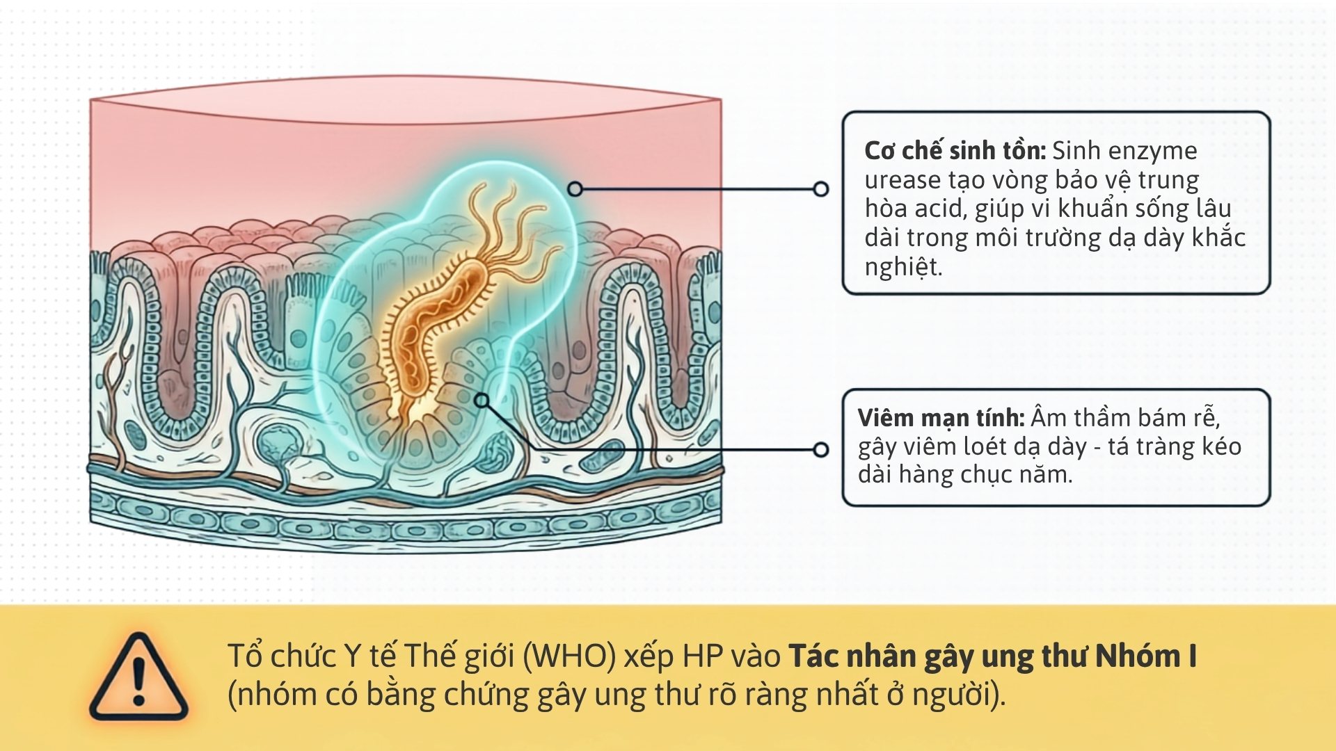 Xet nghiem HP tai Medipath